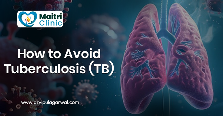 How to Avoid Tuberculosis (TB)